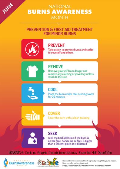 National Burns Awareness Month